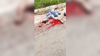 This Guy's Head Was Crushed.