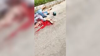 This Guy's Head Was Crushed.