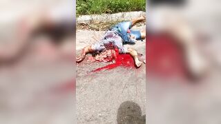 This Guy's Head Was Crushed.