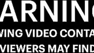 Fire Breather Sets His Own Face On Fire When Performance Goes Wrong