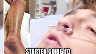 Florida Man Bitten By Diamondback Rattlesnake