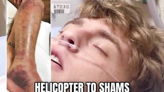 Florida Man Bitten By Diamondback Rattlesnake