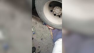 Football Fan's Legs And Dreams Destroyed By Truck