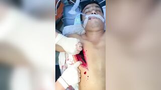 Horrible Accident While Working With A Grinding Wheel