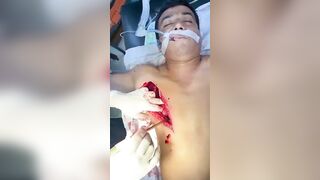 Horrible Accident While Working With A Grinding Wheel