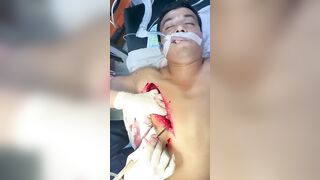 Horrible Accident While Working With A Grinding Wheel