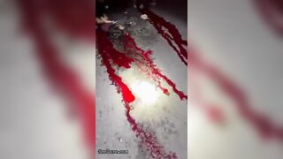 Head Severed In Horrific Bike Accident