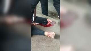 Her Feet Were Destroyed