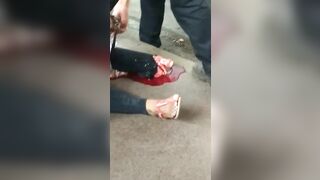 Her Feet Were Destroyed