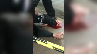 Her Feet Were Destroyed