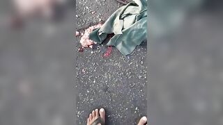 Horrible Aftermath Of A Car Accident