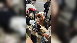 Serious Leg Injuries After Motorcycle Accident