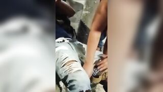 Serious Leg Injuries After Motorcycle Accident