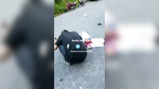 Horrible Consequences Of An Accident Between A Motorcyclist And A Truck