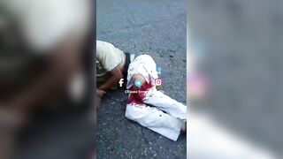 Horrible Consequences Of An Accident Between A Motorcyclist And A Truck