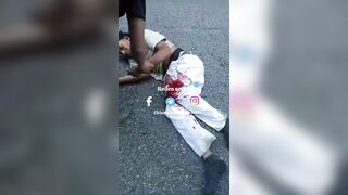 Horrible Consequences Of An Accident Between A Motorcyclist And A Truck