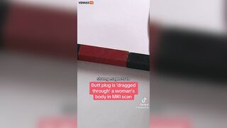 Patient With Metal Sex Toy In Butt Seriously Injured