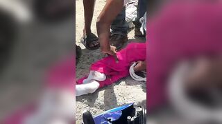Motorcyclist Suffers Serious Leg Injuries After Crashing Under Truck