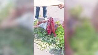 The Legs Were Completely Destroyed