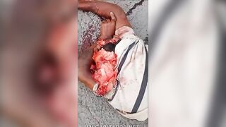 Man Torn To Pieces By Truck