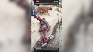 Man Shocked As He Tries To Sew His Severed Leg Back Together