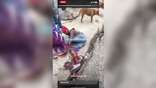 Man Shocked As He Tries To Sew His Severed Leg Back Together