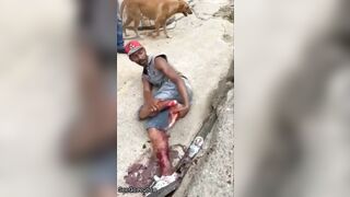 Man Tries To Sew Severed Leg Back Together