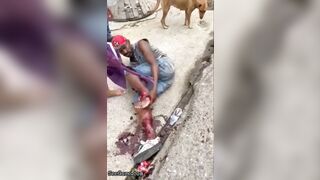 Man Tries To Sew Severed Leg Back Together