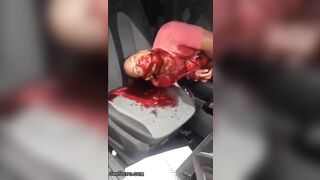 Man Seriously Injured In Accident