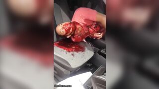 Man Seriously Injured In Accident