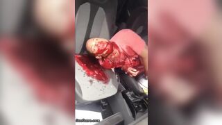 Man Seriously Injured In Accident
