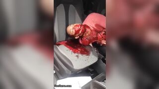 Man Seriously Injured In Accident