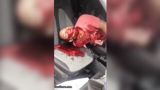 Man Seriously Injured In Accident