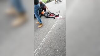 Man Breaks Leg In Accident