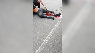 Man Breaks Leg In Accident