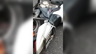 Man Breaks Leg In Accident