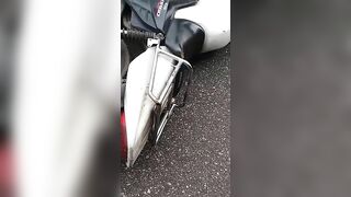 Man Breaks Leg In Accident