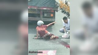 Paramedics Try To Help A Woman With A Foot Injury