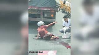 Paramedics Try To Help A Woman With A Foot Injury