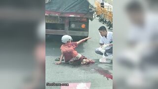 Paramedics Try To Help A Woman With A Foot Injury