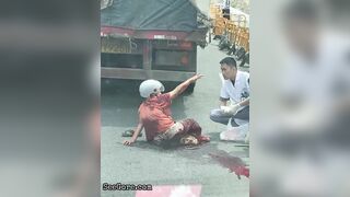 Paramedics Try To Help A Woman With A Foot Injury
