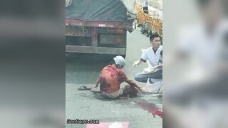 Paramedics Try To Help A Woman With A Foot Injury