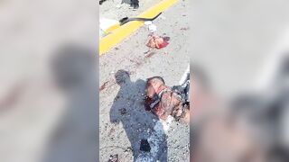 Bus Accident In La Libertad, Peru Leaves More Than 13 Injured