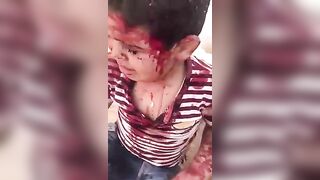 Many People Died In The Accident
