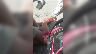 The Knee Is Screwed