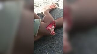 The Knee Is Screwed