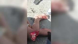 The Knee Is Screwed