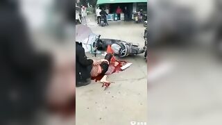 The Woman's Leg Was Broken