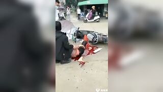 The Woman's Leg Was Broken