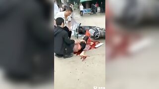 The Woman's Leg Was Broken